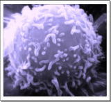 ひらめき　パーキンソン病のメカニズム