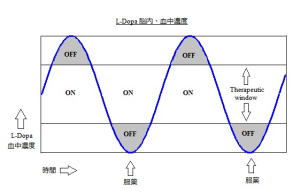 パーキンソン病・治療と療法