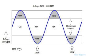 ひらめき　パーキンソン病薬・検査レポート