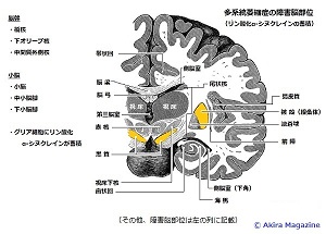 未病神経病理 未病神経病理 Amazon.co.jp: 神経病理形態学 : 水谷 俊雄