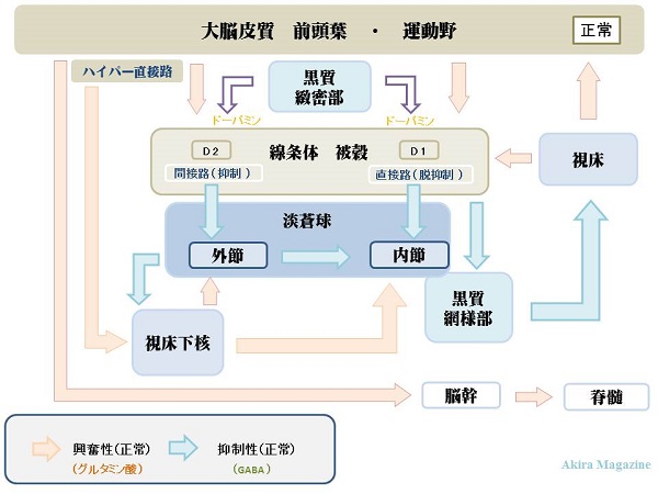 ひらめき　パーキンソン病のメカニズム